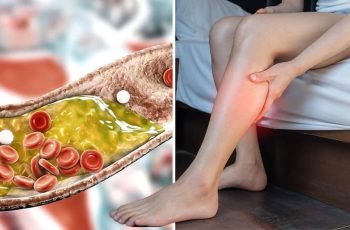 Sáng thức dậy gặp 6 dấu hiệu này, coi chừng “đột quỵ”