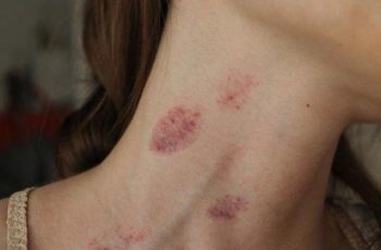 Vợ chồng ‘thân mật’ nồng nhiệt tới mấy cũng phải tránh hôn bộ phận này kẻo đột tử