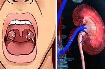 Miệng bị khô và đắng khi ngủ ban đêm thì cần đi khám ngay vì có thể bạn đang mắc 5 bệnh này
