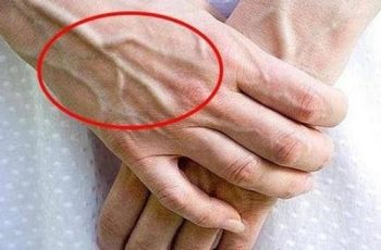 Vì sao tay xuất hiện gân xanh? Cẩn thận nếu bạn có ở những vị trí này!