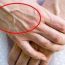 Vì sao tay xuất hiện gân xanh? Cẩn thận nếu bạn có ở những vị trí này!