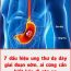 7 dấu hiệu ung thư dạ dày giai đoạn sớm, ai cũng cần biết kẻo di căn xa