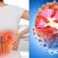 8 dấu hiệu suy thận nhẹ bị nhiều người bỏ qua, chỉ tới lúc nặng mới biết
