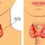 Khi UT vòm họng ban đầu “ghé thăm”, cơ thể có thể phát đi 3 “tín hiệu” đỏ, cố gắng đừng phớt lờ