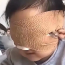 Bé gái 6 tuổi mất cả 2 mắt vì thứ nhiều bố mẹ vẫn cho con chơi mỗi ngày