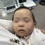Bé gái 1 tuổi bị bầm tím mặt khi gửi nhà trẻ ở Bắc Ninh: Công an tạm giữ cô giáo
