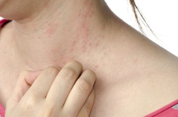 Bị ngứa vào ban đêm, người phụ nữ đi khám mới biết chỉ còn sống được 8 tháng