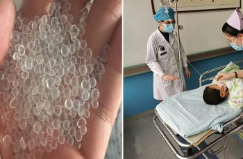 Bé trai 3 tuổi ăn nhầm hạt hút ẩm, mẹ bình tĩnh ứng phó cứu sống con, bác sĩ cũng dành lời khen Bé trai 3 tuổi ăn nhầm hạt hút ẩm, mẹ bình tĩnh ứng phó cứu sống con, bác sĩ cũng dành lời khen