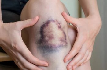 Người có 4 thứ này trên da dễ có “cả đống” tế bào ung thư trong người mà chưa biết Người có 4 thứ này trên da dễ có “cả đống” tế bào ung thư trong người mà chưa biết