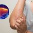 7 dấu hiệu cảnh báo bệnh gan đã đi vào giai đoặn nặng