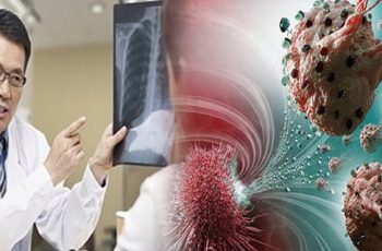 Sɑu nhiều năm, BS nhận ɾɑ Ьệnh nhân ung thư luôn có 6 ƌiểm chung vào Ьuổi sáng: Ngẫm lại quá ƌúng