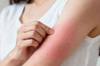 Đừng đợi đến khi phù nề mới đi khám! Bác sĩ chỉ ra 3 dấu hiệu sớm của bệnh thận mà 90% người bỏ qua