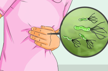 9 triệu chứng UT dạ dày giai đoạn đầu giúp phát hiện sớm bệnh 9 triệu chứng UT dạ dày giai đoạn đầu giúp phát hiện sớm bệnh