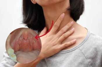 Nhiều người bị UT vòm họng nhưng cứ nghĩ là viêm amidan: BS chỉ cách phân biệt nhờ triệu chứng đi kèm Nhiều người bị UT vòm họng nhưng cứ nghĩ là viêm amidan: BS chỉ cách phân biệt nhờ triệu chứng đi kèm