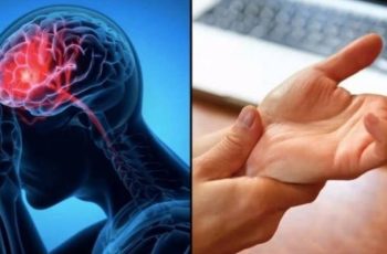 Cảnh báo đột quỵ: Dấu hiệu nhận biết trước 1 tuần, tuyệt đối không được bỏ qua Cảnh báo đột quỵ: Dấu hiệu nhận biết trước 1 tuần, tuyệt đối không được bỏ qua