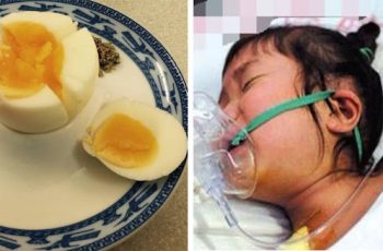 Bé 3t nhập viện sau khi ăn trứng luộc: Cảnh báo 4 thứ tuyệt đối không ăn cùng trứng kẻo đi cấp cứu Bé 3t nhập viện sau khi ăn trứng luộc: Cảnh báo 4 thứ tuyệt đối không ăn cùng trứng kẻo đi cấp cứu