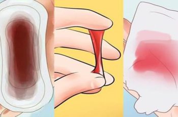 5 dấu hiệu ung thư cổ tử cung sớm nhất: 90% chị em xem thường bỏ qua 5 dấu hiệu ung thư cổ tử cung sớm nhất: 90% chị em xem thường bỏ qua