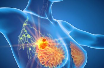 3 thói quen cực xấu của chồng khiến vợ dễ mắc ung thư vú, bỏ ngay! 3 thói quen cực xấu của chồng khiến vợ dễ mắc ung thư vú, bỏ ngay!