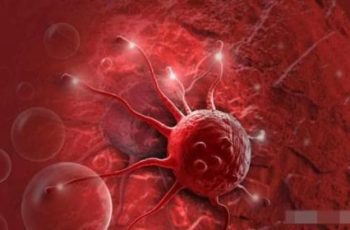 Những người có khối u ác tính trong cơ thể thường biểu hiện 5 dấu hiệu; hãy chú ý kỹ trước khi quá muộn Những người có khối u ác tính trong cơ thể thường biểu hiện 5 dấu hiệu; hãy chú ý kỹ trước khi quá muộn