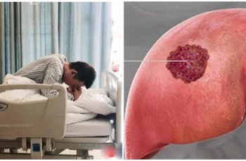 Bệnh nhân qua đời sau 60 ngày phát hiện UT gan, BS khẩn cầu: Đừng ăn 2 món hủy diệt gan nữa Bệnh nhân qua đời sau 60 ngày phát hiện UT gan, BS khẩn cầu: Đừng ăn 2 món hủy diệt gan nữa