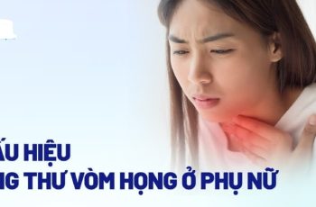 7 dấu hiệu nhận biệt bệnh K vòm họng sớm: Có 1 thôi cũng nên đi khám gấp 7 dấu hiệu nhận biệt bệnh K vòm họng sớm: Có 1 thôi cũng nên đi khám gấp