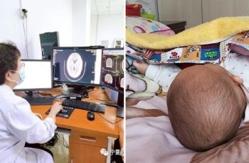 Trẻ ngủ gối và không ngủ gối có 3 điểm khác biệt khi lớn: Không chỉ IQ, cột sống cũng biến đổi bất ngờ Trẻ ngủ gối và không ngủ gối có 3 điểm khác biệt khi lớn: Không chỉ IQ, cột sống cũng biến đổi bất ngờ