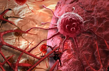 Loại nước “nuôi tế bào UT”, 1 ly mỗi ngày nguy cơ UT tăng 90%, nhiều người Việt uống mỗi ngày Loại nước “nuôi tế bào UT”, 1 ly mỗi ngày nguy cơ UT tăng 90%, nhiều người Việt uống mỗi ngày