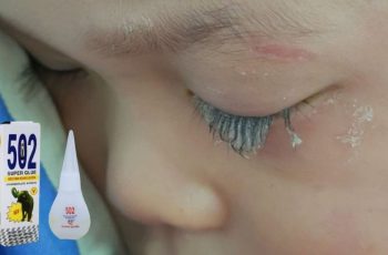 Bé trai 3 tuổi bị keo 502 bắn vào mắt, hành động của người mẹ trong “30 giây vàng” đã cứu con khỏi cảnh mù loà! Bé trai 3 tuổi bị keo 502 bắn vào mắt, hành động của người mẹ trong “30 giây vàng” đã cứu con khỏi cảnh mù loà!