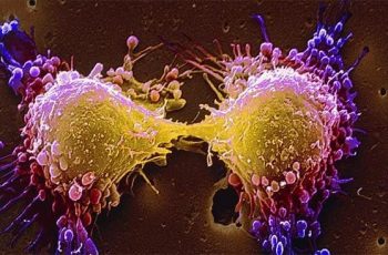 Loại rau phá hủy hơn 90% tế bào UT trong vòng 48h mà người Việt cứ ngỡ là rau dại mọc đầy đường Loại rau phá hủy hơn 90% tế bào UT trong vòng 48h mà người Việt cứ ngỡ là rau dại mọc đầy đường