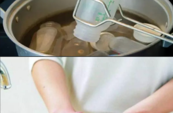 Người lớn vô ý, trẻ con vô viện: Bé 6 tháng vào cấp cứu vì mẹ tráng bình bằng nước sôi Người lớn vô ý, trẻ con vô viện: Bé 6 tháng vào cấp cứu vì mẹ tráng bình bằng nước sôi