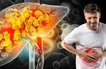 Nghiên cứu khoa học chỉ rõ 1 việc giúp đảo ngược tình trạng gan nhiễm mỡ: Muốn bảo vệ gan, hãy làm ngay Nghiên cứu khoa học chỉ rõ 1 việc giúp đảo ngược tình trạng gan nhiễm mỡ: Muốn bảo vệ gan, hãy làm ngay