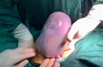 Mẹ bầu sinh năm 1990 đã đẻ ra một ‘đứa con thạch’, người bố đi cùng sợ không dám bế con nhưng bác sĩ lại chúc mừng Mẹ bầu sinh năm 1990 đã đẻ ra một ‘đứa con thạch’, người bố đi cùng sợ không dám bế con nhưng bác sĩ lại chúc mừng