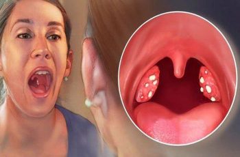 Loại lá dân dã trị viêm họng “nhạy hơn kháng sinh”: Đau rát đến mấy cứ ngậm vài lần sẽ đỡ Loại lá dân dã trị viêm họng “nhạy hơn kháng sinh”: Đau rát đến mấy cứ ngậm vài lần sẽ đỡ