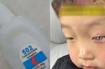 Con bị keo 502 bắn vào mắt, bố nhẹ nhàng đổ thêm một thứ, bác sĩ khen: Hiếm có người thông minh như anh! Con bị keo 502 bắn vào mắt, bố nhẹ nhàng đổ thêm một thứ, bác sĩ khen: Hiếm có người thông minh như anh!