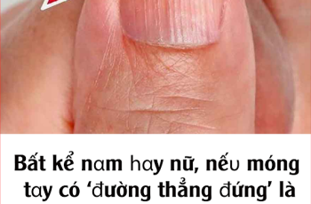 Bất kể nam hay nữ, nếu móng tay có ‘đường thẳng đứng’ là 3 bệnh bước vào cửa, khám ngay kẻo hối hận Bất kể nam hay nữ, nếu móng tay có ‘đường thẳng đứng’ là 3 bệnh bước vào cửa, khám ngay kẻo hối hận